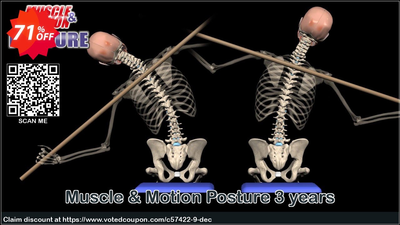 Muscle & Motion Posture 3 years Coupon Code May 2024, 71% OFF - VotedCoupon